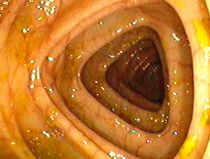 Colon transversum (Dickdarm) Colon transversum (Dickdarm)